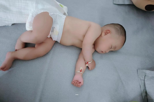 嵊州宝宝脸上有白色斑块